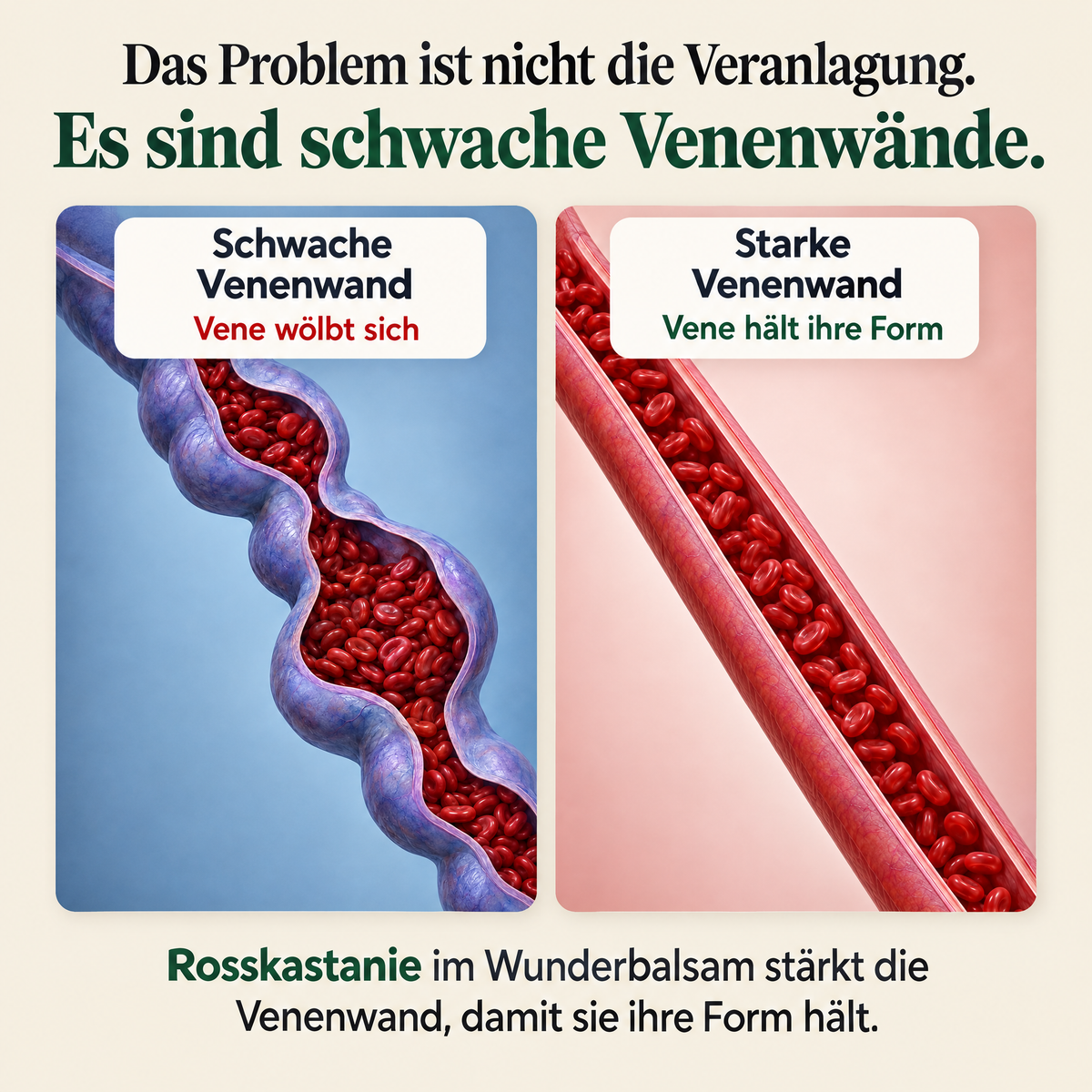 Schwache und starke Venenwand im Vergleich